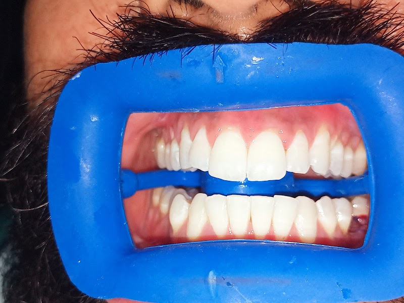 Vogue Dental & Implant Centre Burewala in Burewala, Punjab