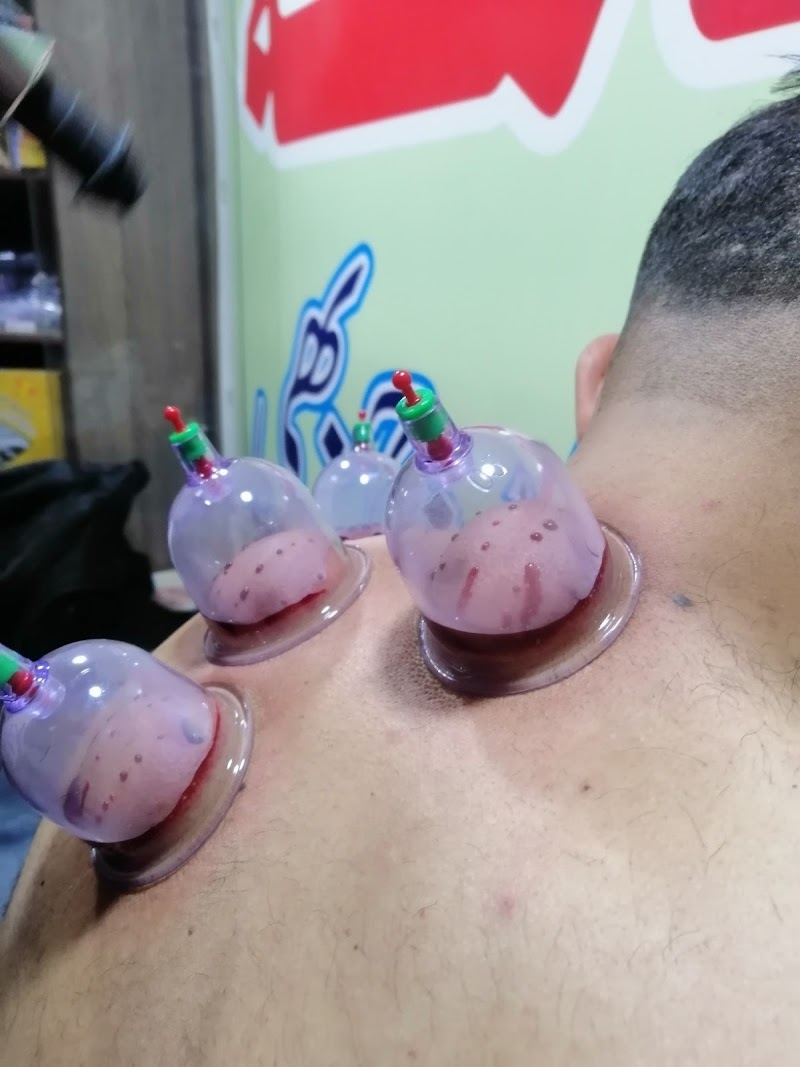 Mehboob Hijama Centre | Ladies & Gents Hijama Center Rawalpindi in Rawalpindi, Punjab