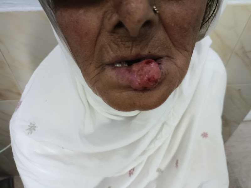 Dr.Luqman Ali ,Dermatologist/ Cosmetologist & Aesthetic Surgeon, Pediatric Dermatologist in Jhang