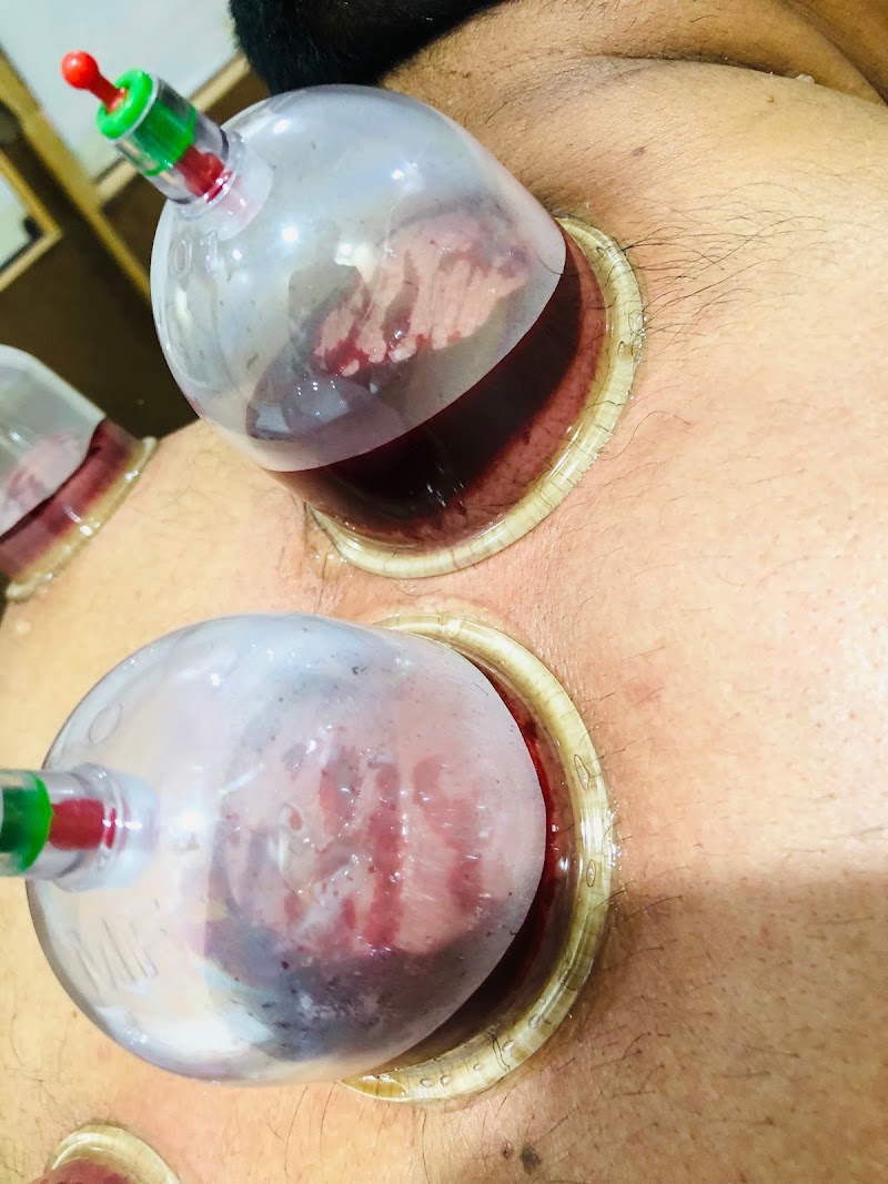 Hijama center sahiwal (Herbal & physiotherapy) in Sahiwal, Punjab