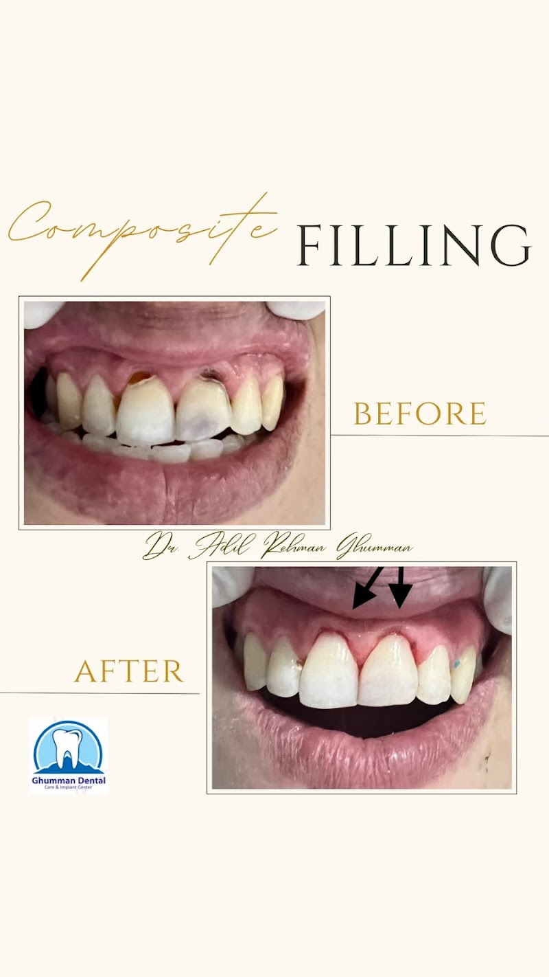 Ghumman Dental Care in Burewala, Punjab