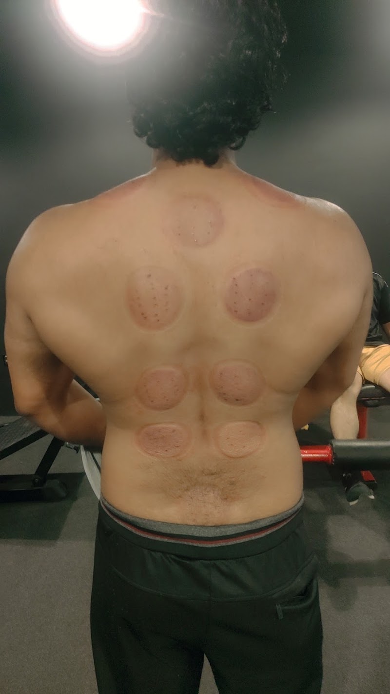 Best Physiotherapist, Chiropractor & Hijama Services in Sialkot in Sialkot, Punjab