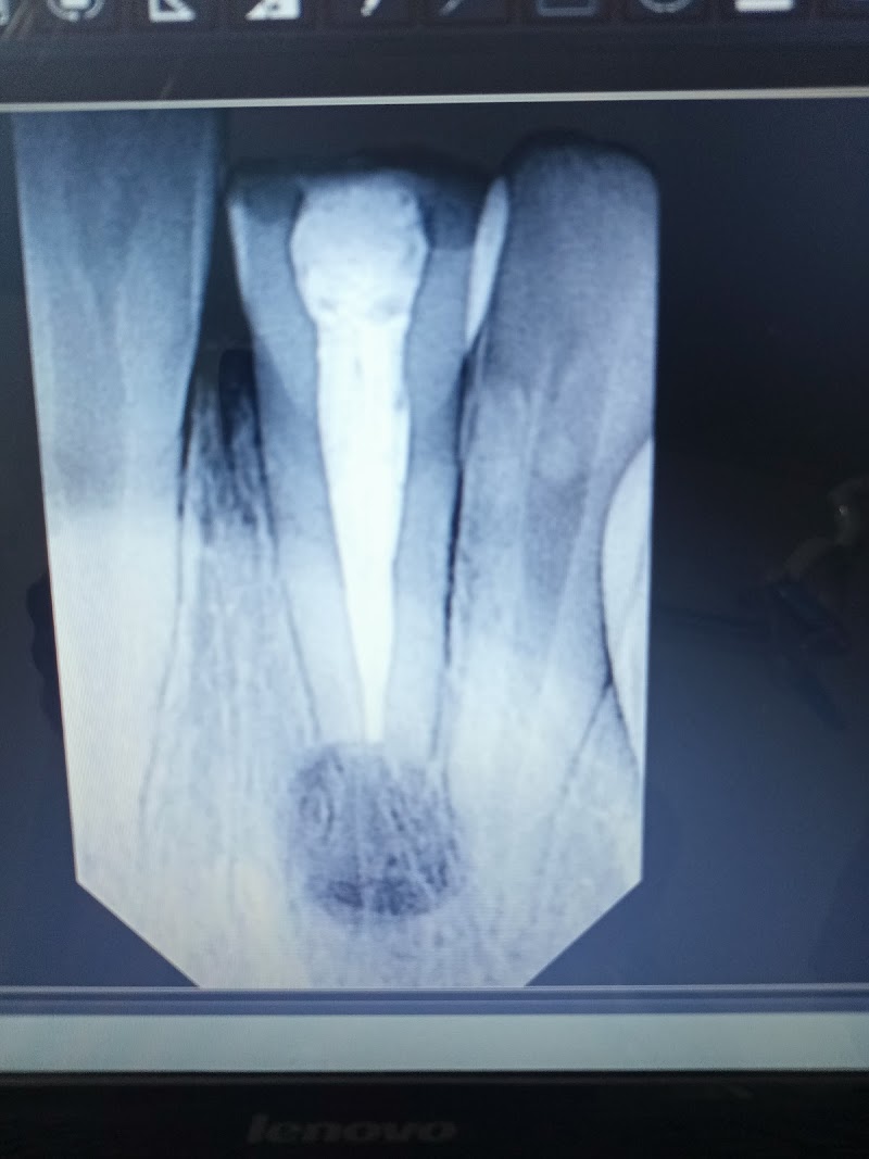 Vogue Dental & Implant Centre Burewala in Burewala, Punjab