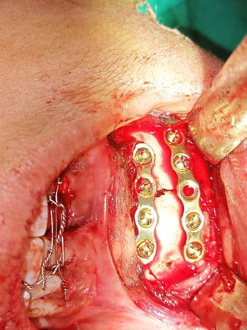 Vogue Dental & Implant Centre Burewala in Burewala, Punjab