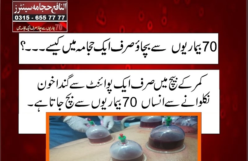 Al Nafay Hijama Centers Gujrat Branch in Gujurat, Punjab