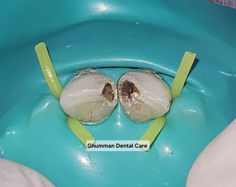 Ghumman Dental Care in Burewala, Punjab