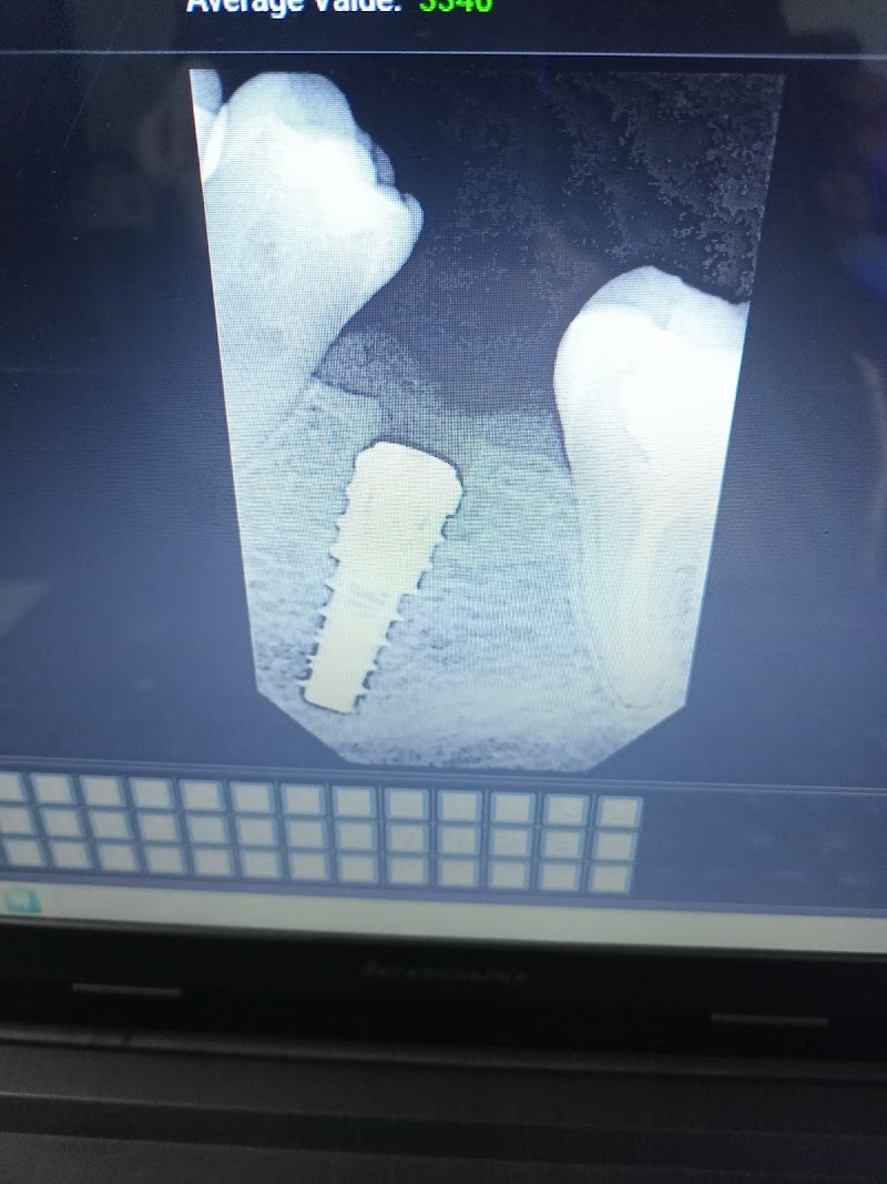 Vogue Dental & Implant Centre Burewala in Burewala, Punjab