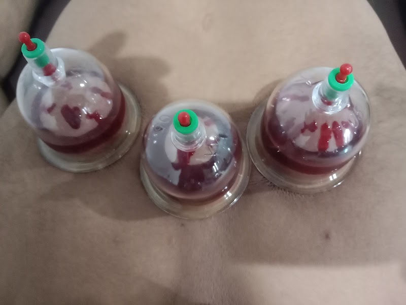 Royal hijama and pain management center Royal city Bahawalpur in Bahawalpur, Punjab