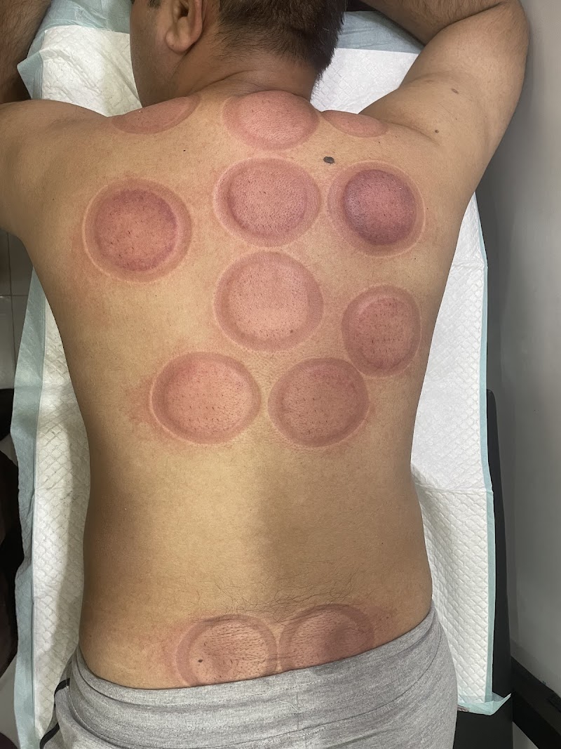 Shafqat Al Hijama Centers Gujranwala in Gujranwala, Punjab