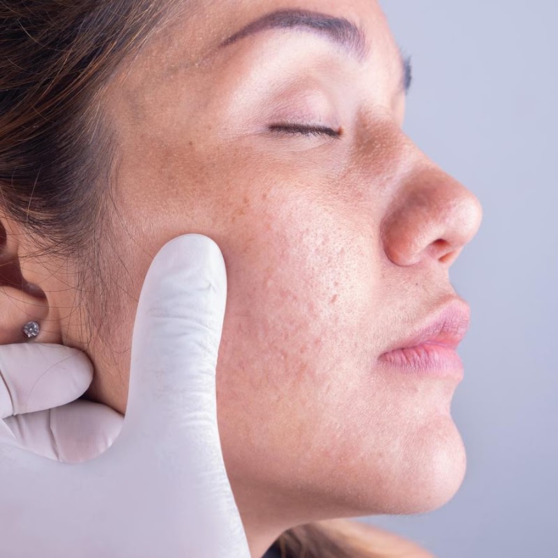 Dr Mohsin Sajad Joiya (MD in Dermatology) SKIN SPECIALIST, CONSULTANT DERMATOLOGIST, LASER SPECIALIST IN COSMOTOLOGIST, Pediatric Dermatologist in Bahawalpur