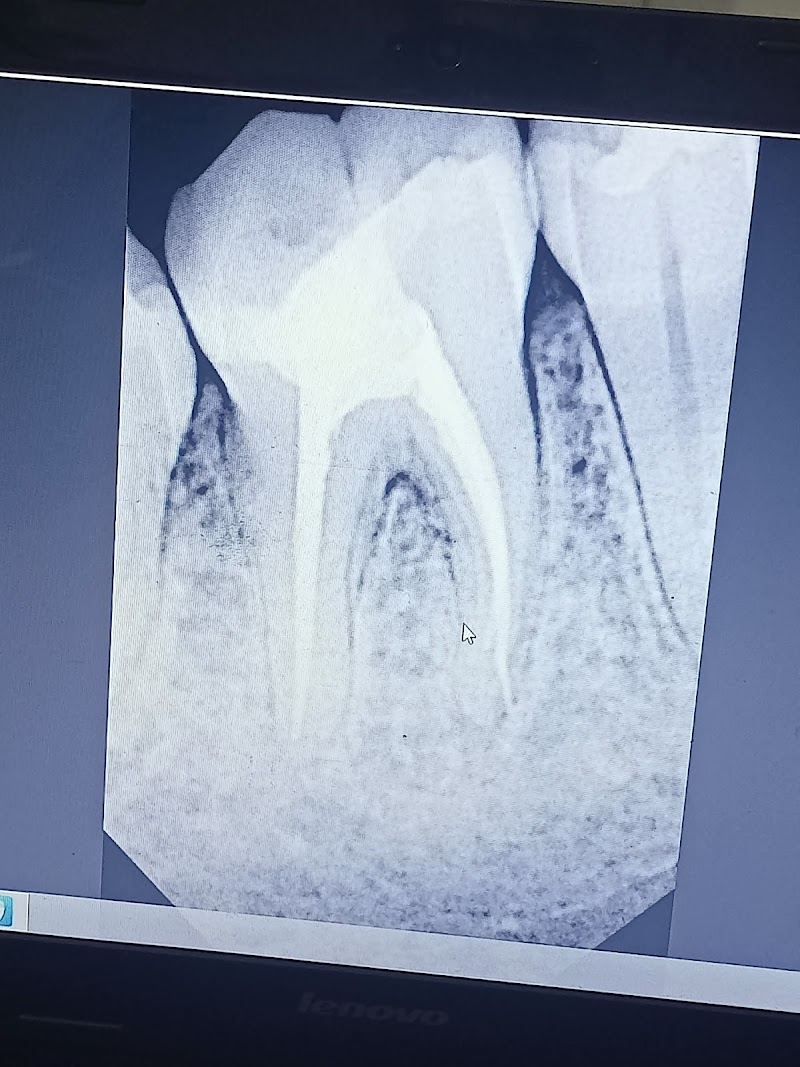 Vogue Dental & Implant Centre Burewala in Burewala, Punjab