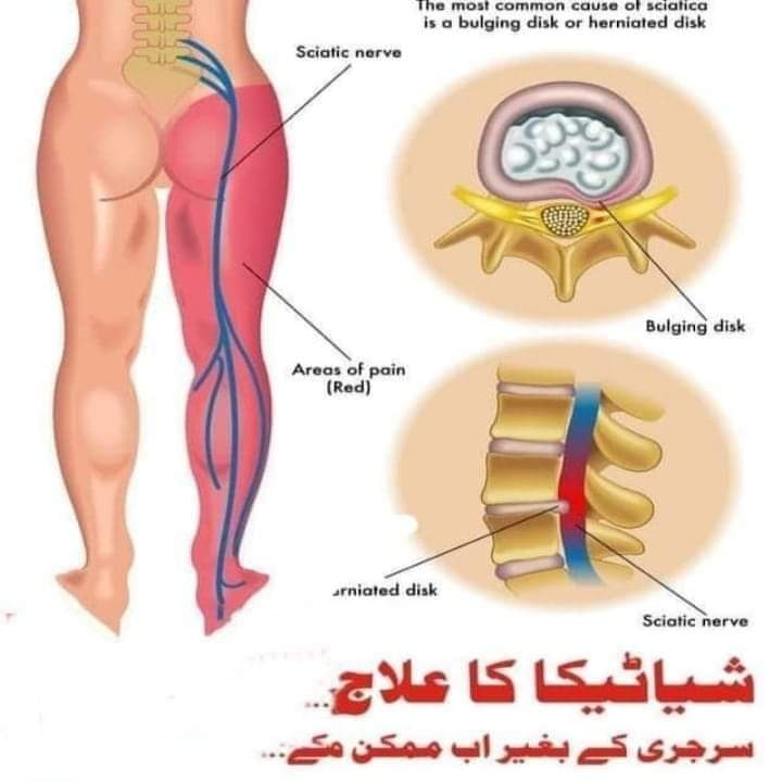 HARAMAIN Herbal clinic And Hijama center Taxila/wah in Wah, Punjab