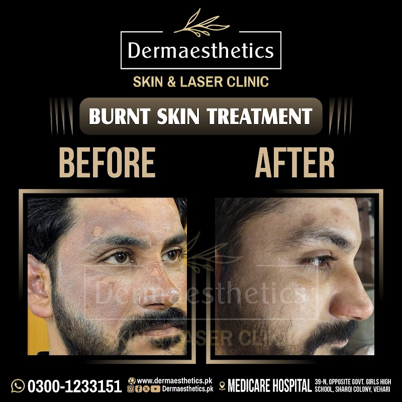 Dermaesthetics Skin and Laser Clinic in Vehari, Punjab