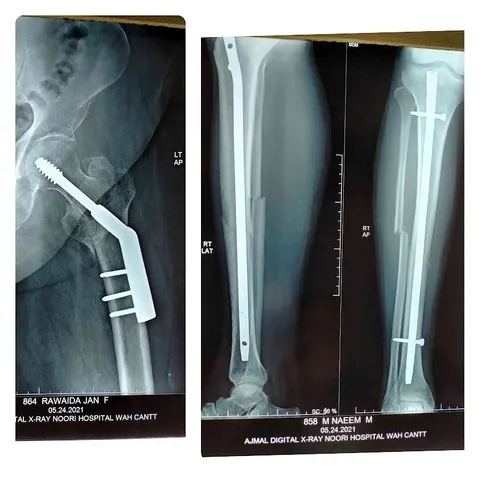 Dr ikram orthopedic clinic in Wah Cantt, Punjab