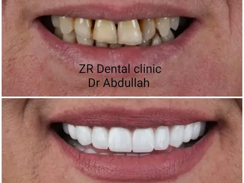 Zr Dental clinic in Gujrat, Punjab