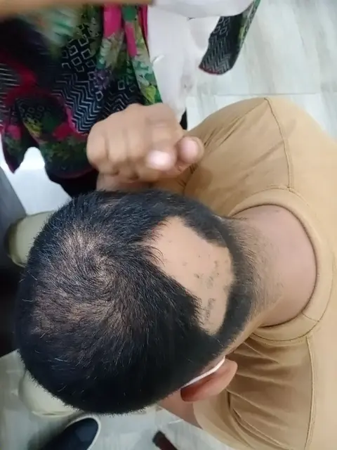 DR IMRAN (dermatologist,cosmetologist ,laser specialist,skin specialist, Prime Skin clinic) in Bahawalpur, Punjab