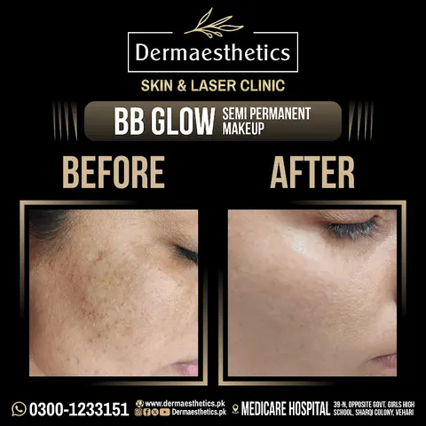 Dermaesthetics Skin and Laser Clinic in Vehari, Punjab