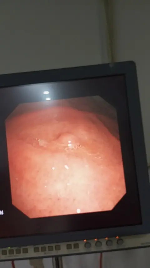 Dr. Nouman Hameed | M.B.B.S., F.C.P.S. (Gasto)| Best Gastroenterologist in Lahore | Endoscopy, Colonoscopy, ERCP Specialist in Lahore, Punjab