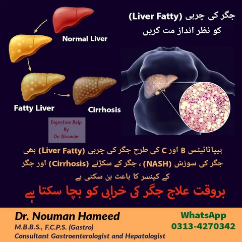 Dr. Nouman Hameed | M.B.B.S., F.C.P.S. (Gasto)| Best Gastroenterologist in Lahore | Endoscopy, Colonoscopy, ERCP Specialist in Lahore, Punjab
