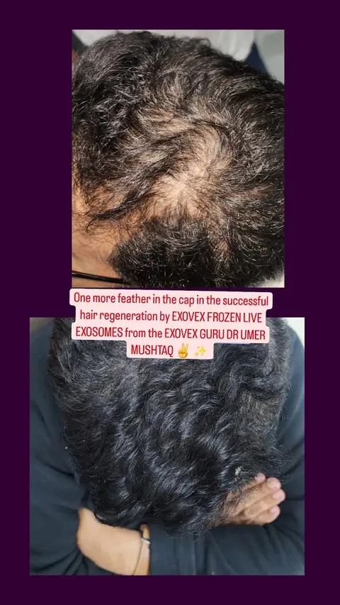 Dr Umer Mushtaq - BEST DERMATOLOGIST IN LAHORE in Lahore, Punjab