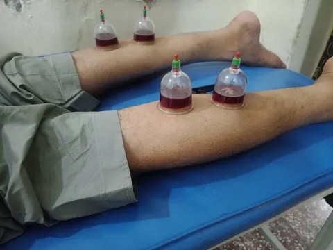 Dar ul Sehat Hijama Center Jhelum in Jhelum, Punjab
