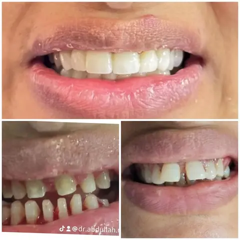 Zr Dental clinic in Gujrat, Punjab