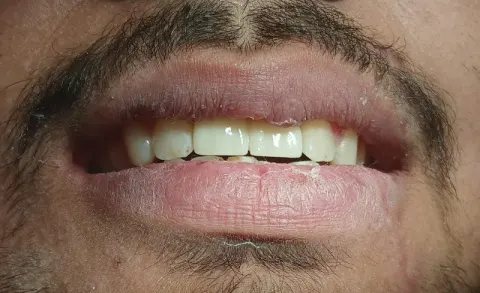 Zr Dental clinic in Gujrat, Punjab