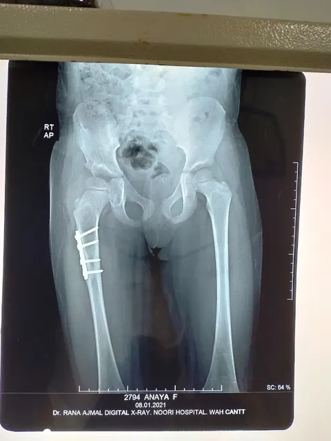 Dr ikram orthopedic clinic in Wah Cantt, Punjab