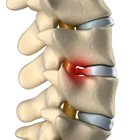 Faisal Physiotherapy and Acupuncture center (FPAC) in Multan, Punjab