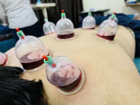 Bukhari Dawakhana & Hijama Center Gujrat