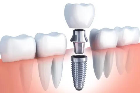 Professional Dental & pediatric care Jhang in Jhang, Punjab
