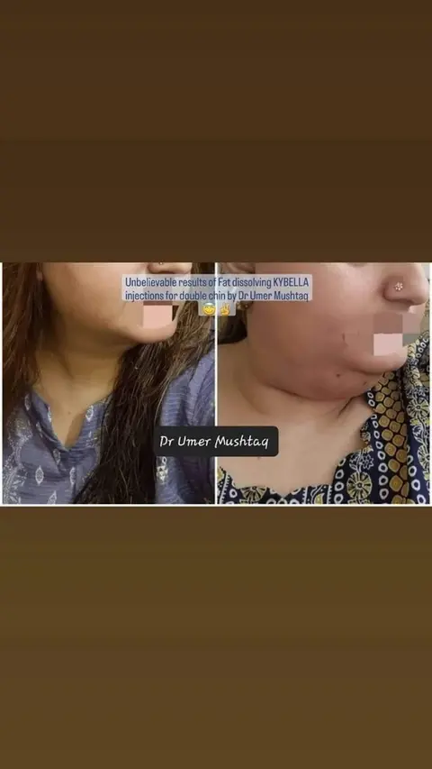 Dr Umer Mushtaq - BEST DERMATOLOGIST IN LAHORE in Lahore, Punjab