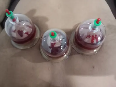 Royal hijama and pain management center Royal city Bahawalpur in Bahawalpur, Punjab