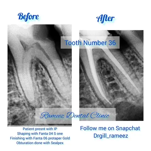 Rameez Dental Clinic in Gojra, Punjab