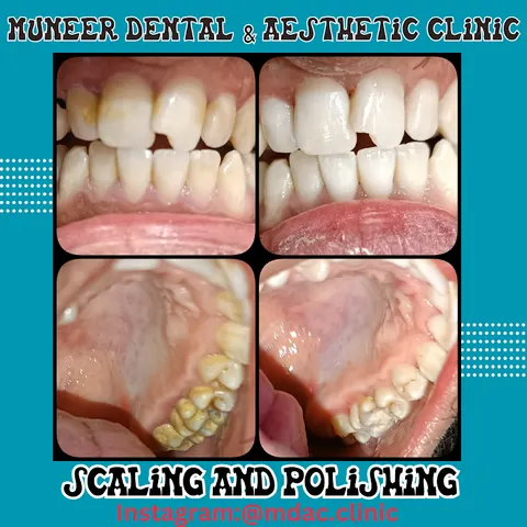 Muneer Dental & Aesthetic Clinic in Jhang, Punjab