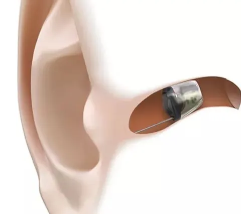 Audiology Centre Islamabad