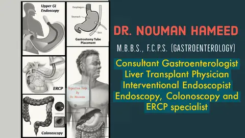 Dr. Nouman Hameed | M.B.B.S., F.C.P.S. (Gasto)| Best Gastroenterologist in Lahore | Endoscopy, Colonoscopy, ERCP Specialist in Lahore, Punjab