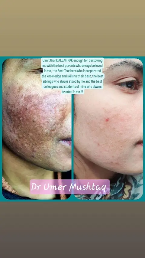 Dr Umer Mushtaq - BEST DERMATOLOGIST IN LAHORE in Lahore, Punjab