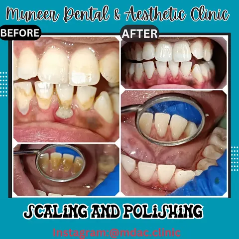 Muneer Dental & Aesthetic Clinic in Jhang, Punjab