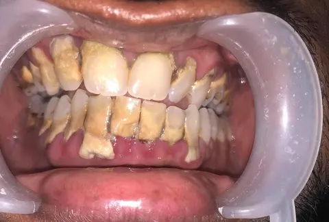 MY DENTIST GUJRAT {Dr Daud Ijaz Chatha} in Gujrat, Punjab