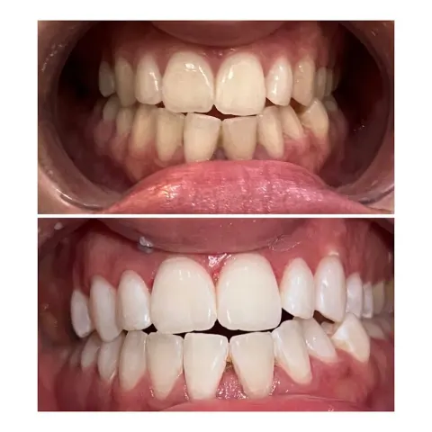 MY DENTIST GUJRAT {Dr Daud Ijaz Chatha}