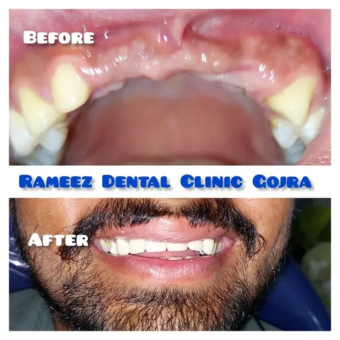 Rameez Dental Clinic in Gojra, Punjab