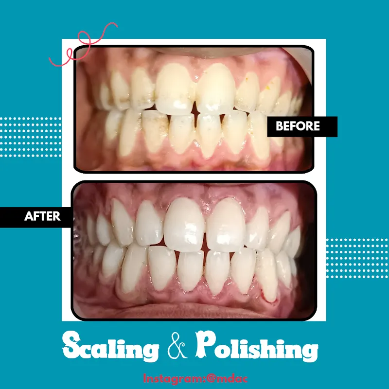 Muneer Dental & Aesthetic Clinic, Dental Implants Provider in Jhang